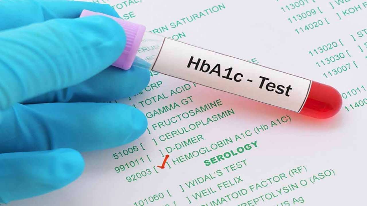 Test tiểu đường thai kỳ tại nhà bằng xét nghiệm HbA1c 
